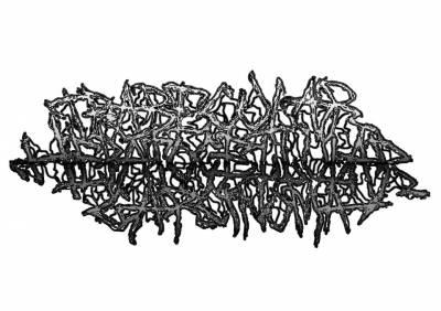 logo Trabecular Hepatocellular Carcinoma